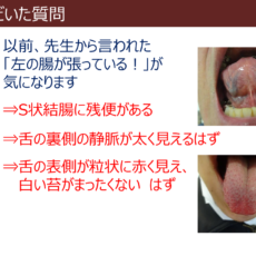 腸の状態を舌でチェック！